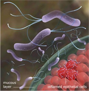 h-pylori-invasion-epithelial-cells-mucous-layer
